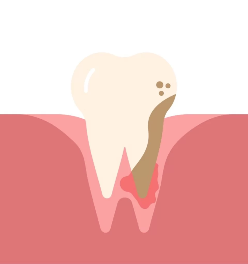 Dentist in Clyde North, Clyde North Dental payment plans