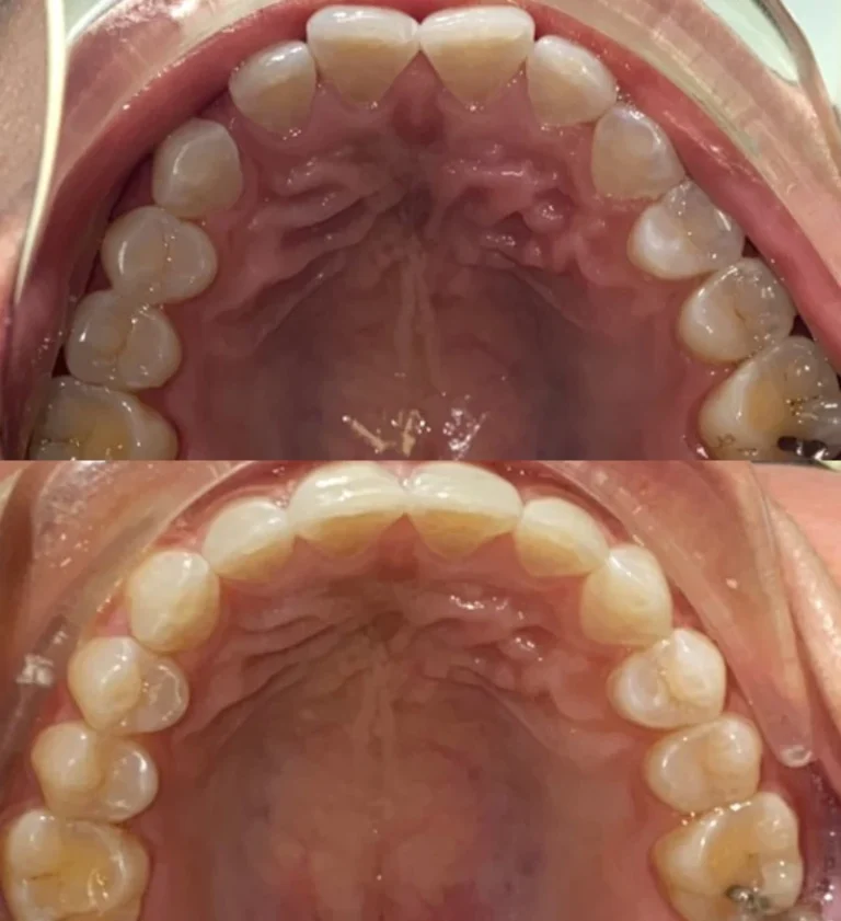 Before and after dental treatment result 19
