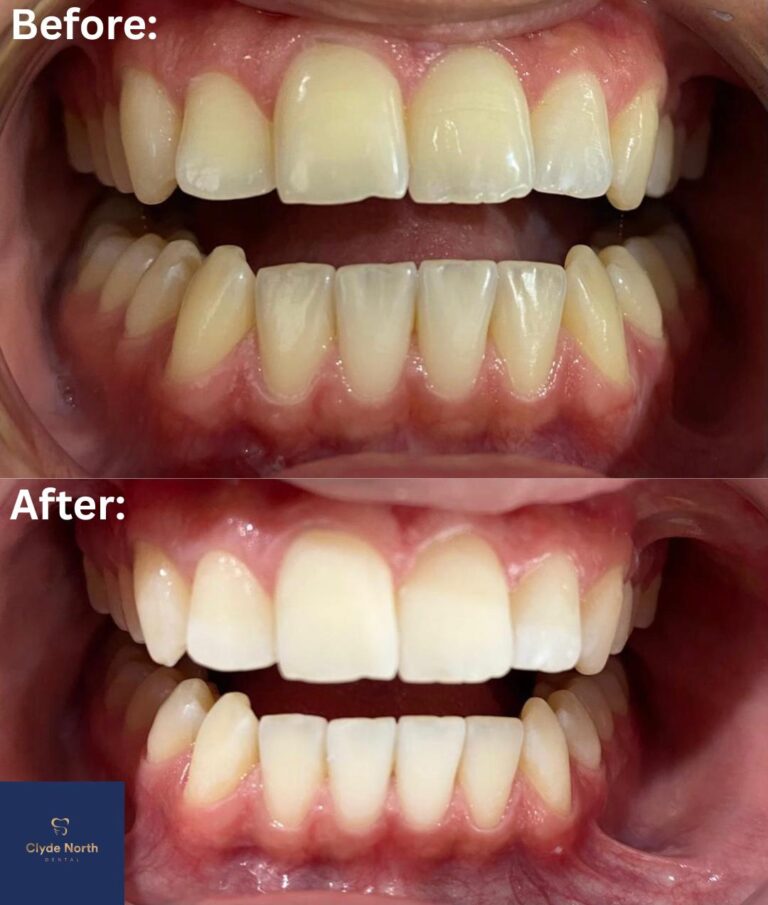 Before and after dental treatment result 25